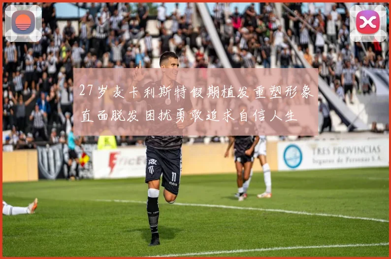 27岁麦卡利斯特假期植发重塑形象直面脱发困扰勇敢追求自信人生
